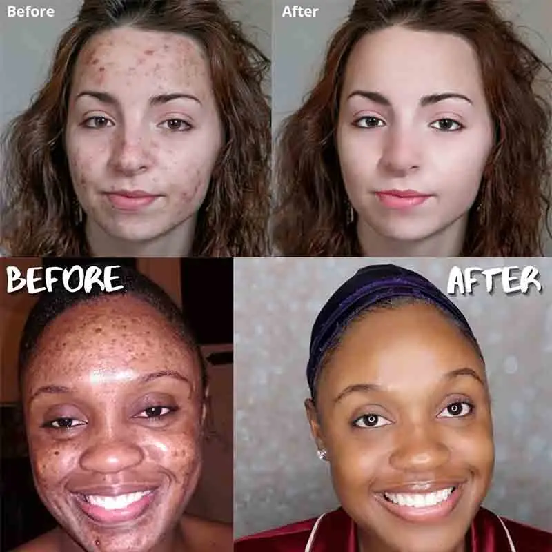 Buy Kf s7849b534a6684ebc9a19de29b239751fg in America.